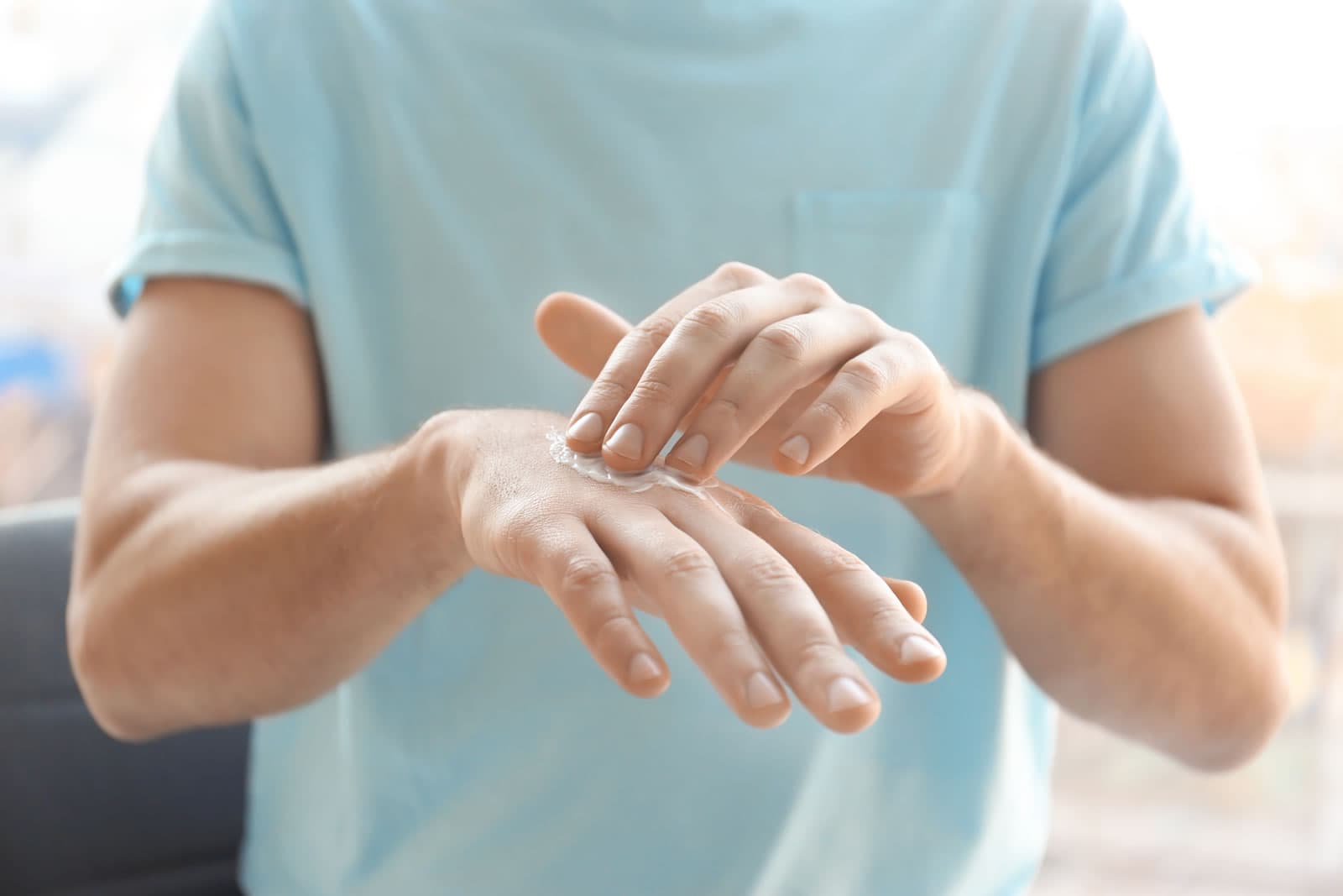 Eczema. Close up of young man in T-shirt applying hand cream