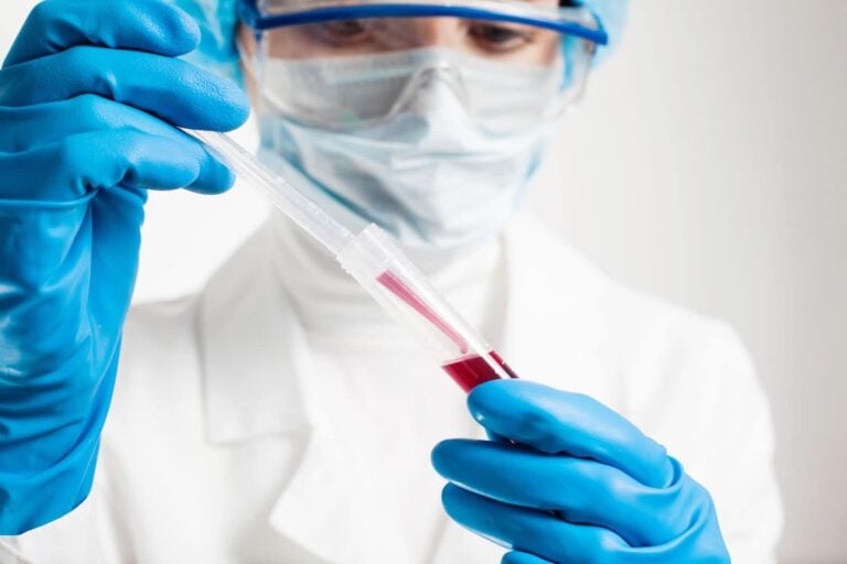 lab technician wearing gloves and protective glasses handling blood sample